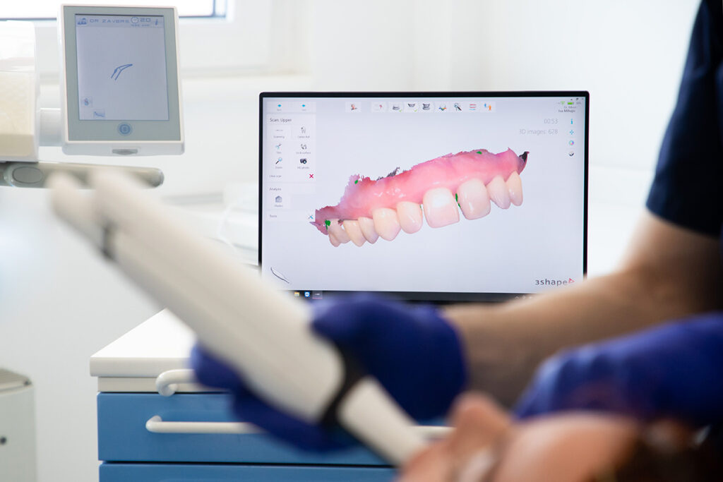3D intraoral scanner capturing digital impressions of a patient's teeth at Trust Dental Surgery