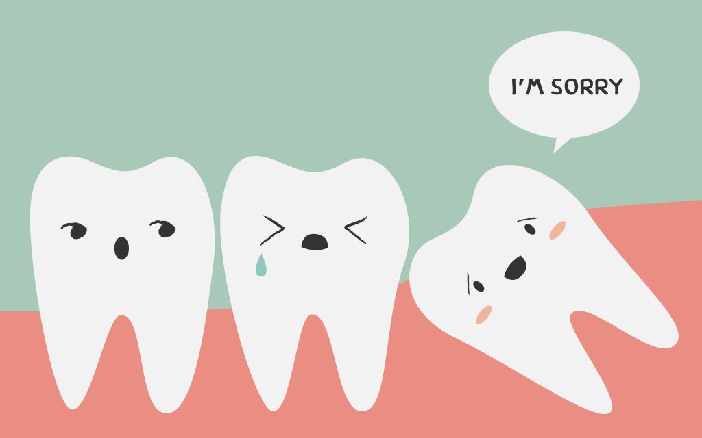 WIsdom-Tooth-extraction-surgery-singapore WIsdom-Tooth-extraction-surgery-singapore